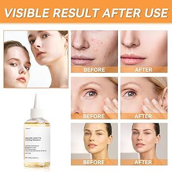 The Ordinary Glycolic Acid 7% Toner Solution | Exfoliating Toner for Radiant Skin